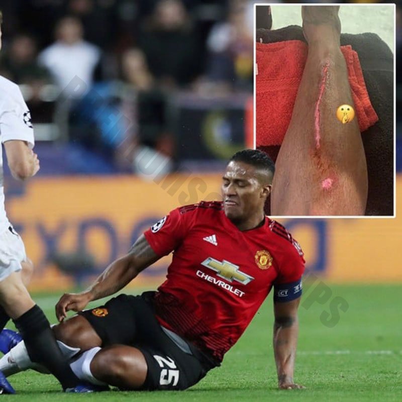 Antonio Valencia - The worst injuries in football